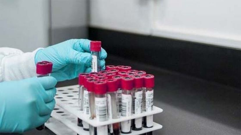 英出现首宗人类感染甲型H1N2流感病例。