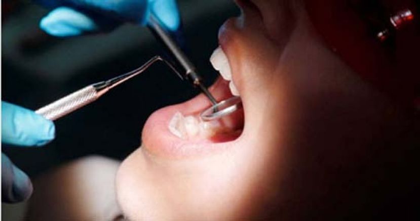 牙周病患染疫死亡风险增8倍　隐形口罩戴好戴满