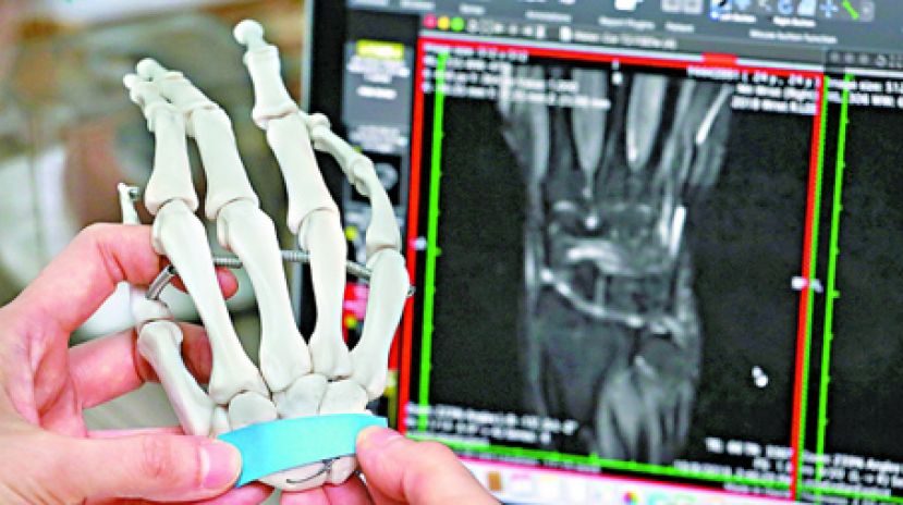 肌力不足撑地受压 热舞烧脂小心腕骨折