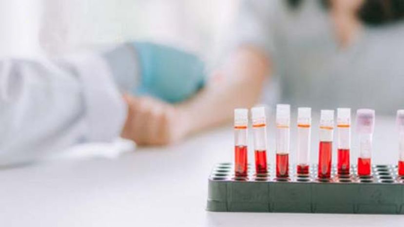 三阴性乳癌好发年轻女性、存活率低　建议基因检测