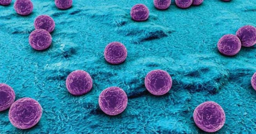  金黄色葡萄球菌存在环境当中，但是一但感染，常引发严重发炎。