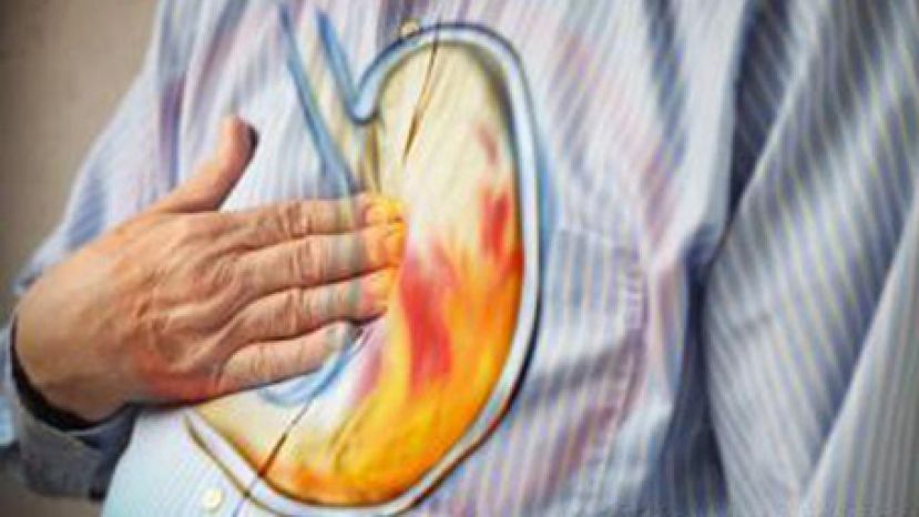 胃酸上逆勿轻视 自我缓解及食物调理