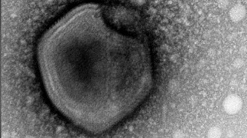 科学家从西伯利亚永冻土分离出多株古老病毒毒株，都能感染人工培育的单细胞变形虫。