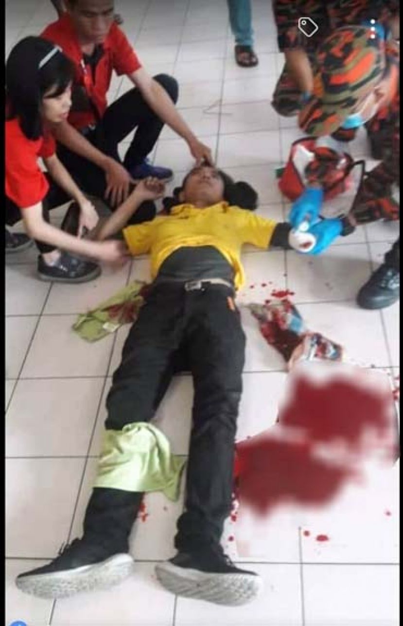 青年左手及腿部中刀，倒地等待救援。