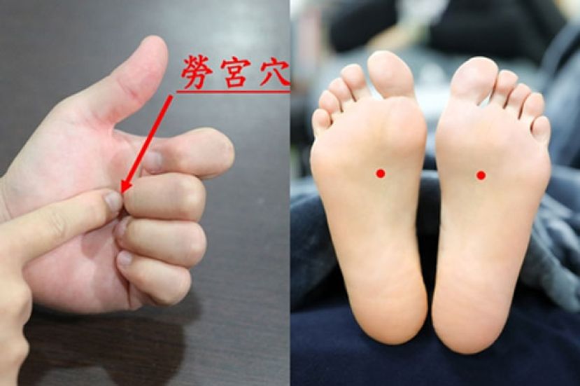 中医师建议，想要改善手脚冰冷，可以按摩手掌的劳宫穴（图左）和脚底的涌泉穴（图右）。
