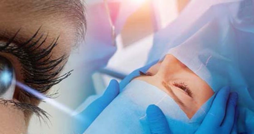 &ldquo;不掀瓣&rdquo;、&ldquo;零接触&rdquo; 近视雷射成趋势　专家吁做好术前评估