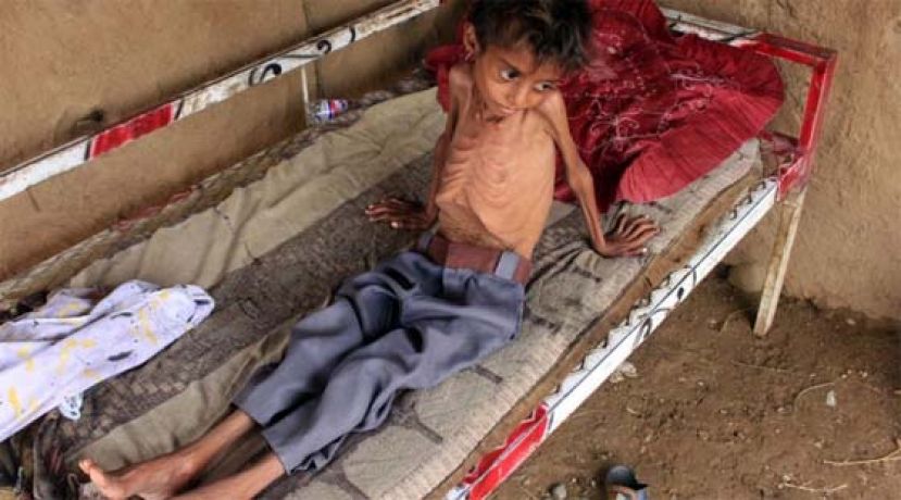  联合国11日表示，也门内战近8年前升高至今，已导致1万1000多名儿童丧生或残疾。