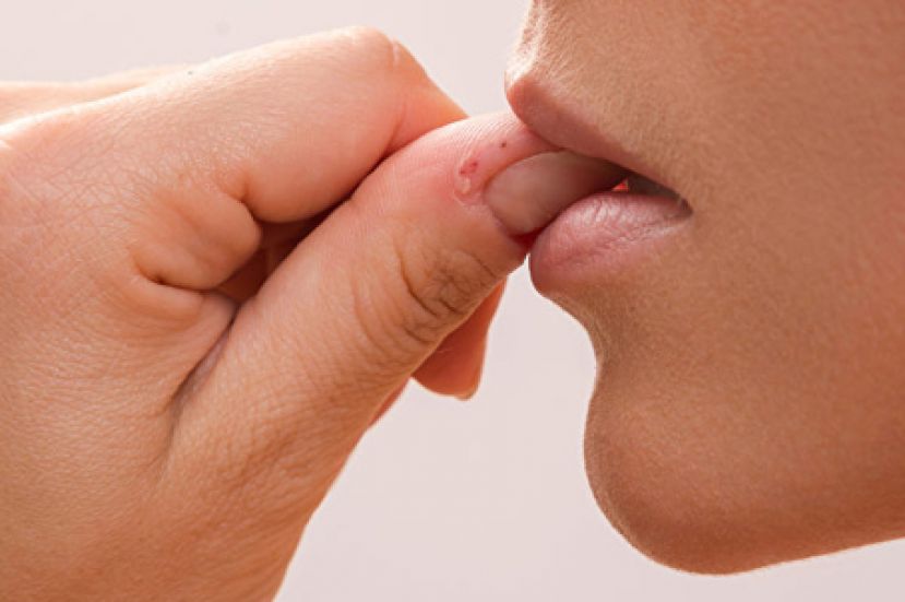 为什么总是咬指甲？三大原因看你是哪种