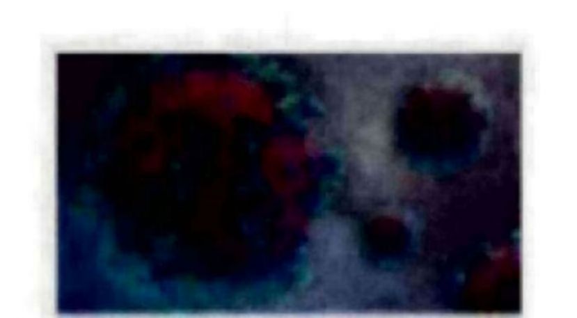 《新冠肺炎》大马新增1597确诊6病逝　