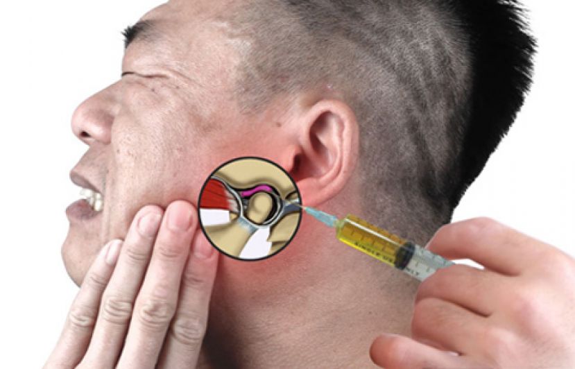 轻视颞颚关节障碍 恐下巴后缩脸歪