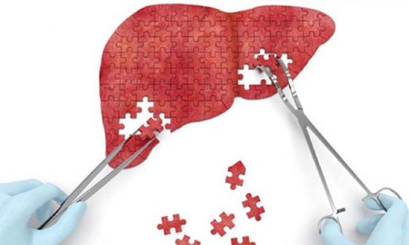 洗肾C肝微根除　高医ERASE-C计画独步全球