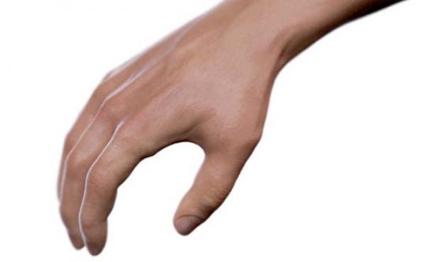 流浪狗叼断手乱窜啃咬。