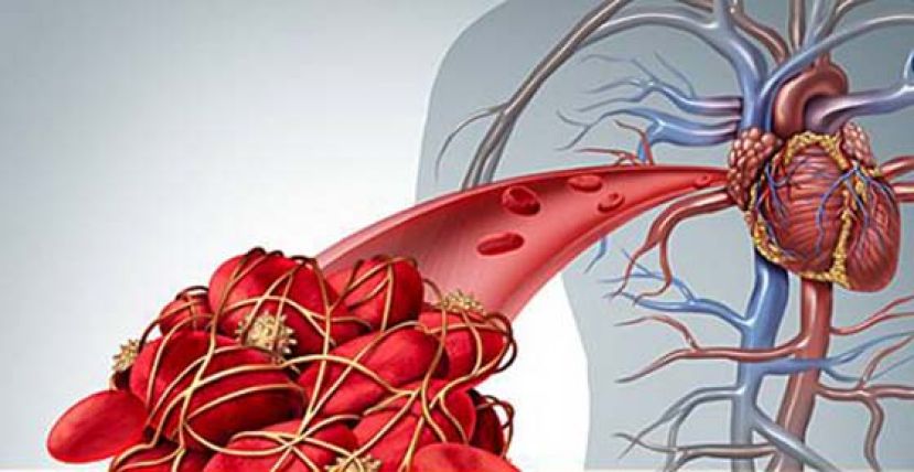 主动脉病患使用FQ抗生素　长庚研究：死亡风险增加