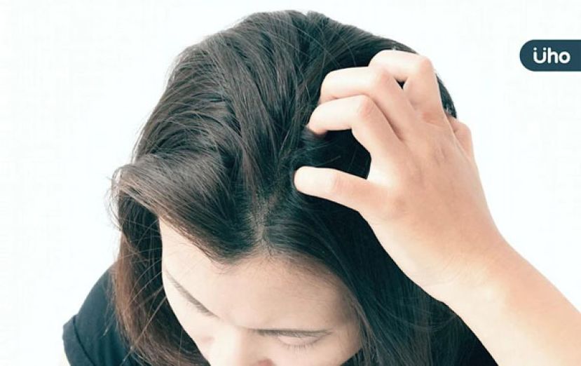 天热头痒头皮屑多　医列6大征兆恐致掉发