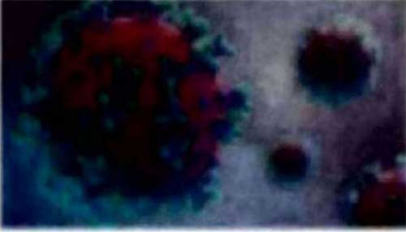 《新冠肺炎》  大马新增2636确诊11疫殁