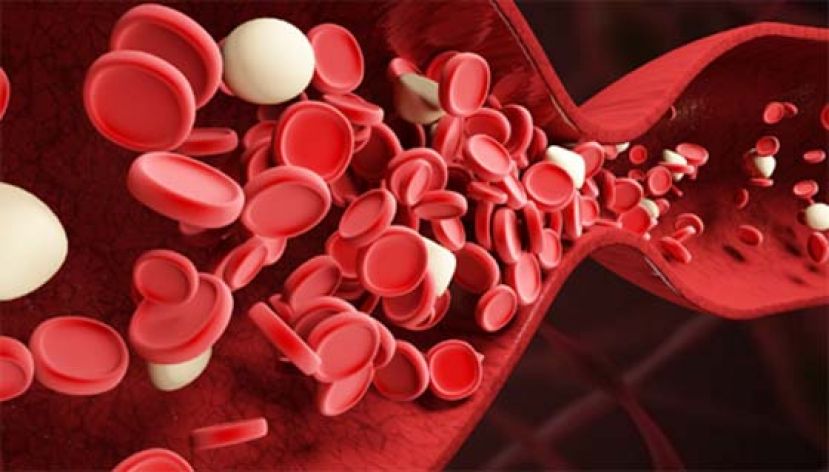 她牙龈肿胀以为火气大　牙医一句话竟验出急性血癌