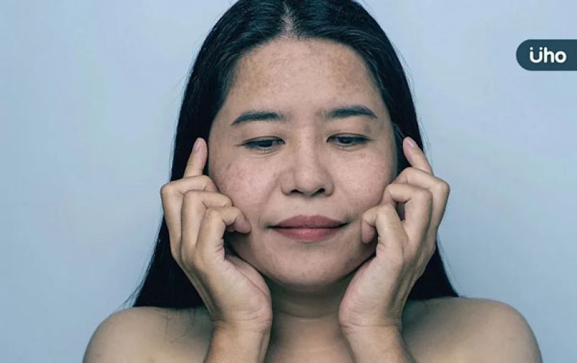 快速瘦身恐害皮肤垮　营养师教3招吃对餐食比例