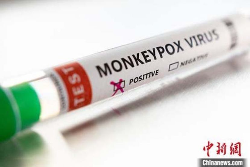 资料图为猴痘病毒阳性标本。