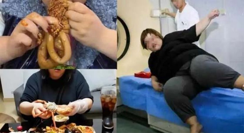 中国吃播网红直播间猝死，腹部变形胃塞满未消化食物。