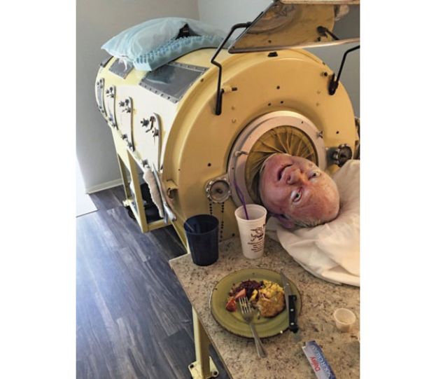 &ldquo;铁肺男&rdquo;亚历山大逝世。