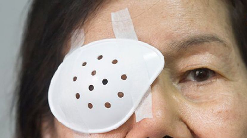 白内障开刀别拖　6旬妇眼剧痛、恶心呕吐才知青光眼