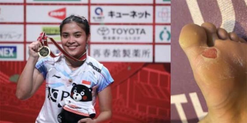 玛丽斯卡拼到脚底老茧撕裂，成为印尼近20年第一人。