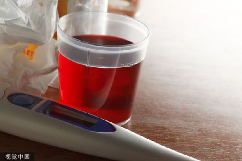 印尼有131名儿童疑因服用受污染印度咳嗽药水而出现肾衰竭症状。