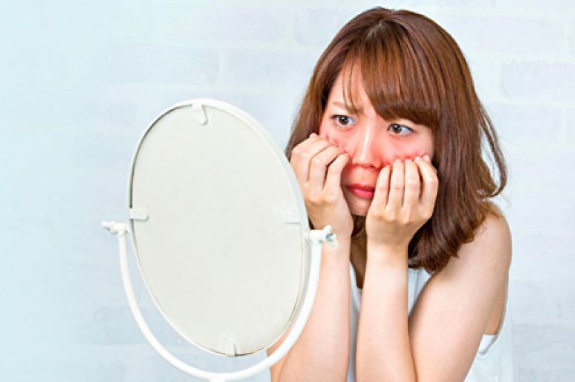 脸总是红红可能是酒糟鼻 医师如何调理？