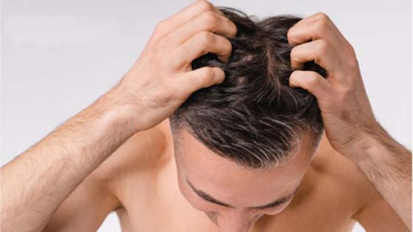 头冒红疹误当湿疹　拖数年竟是癌前病变