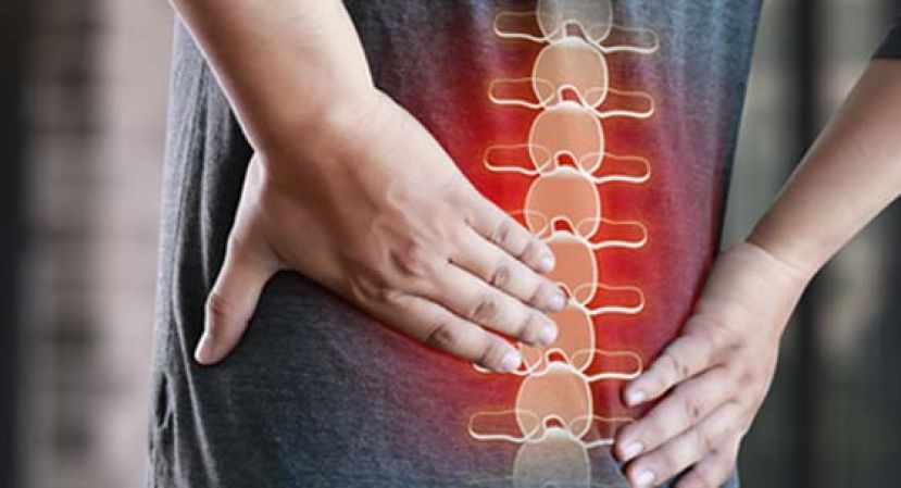 发烧合并下背剧痛　他一照Ｘ光腰椎盘竟蛀光