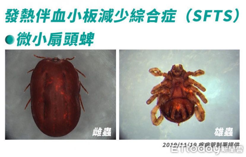 SFTS主要是经由蜱虫叮咬感染。