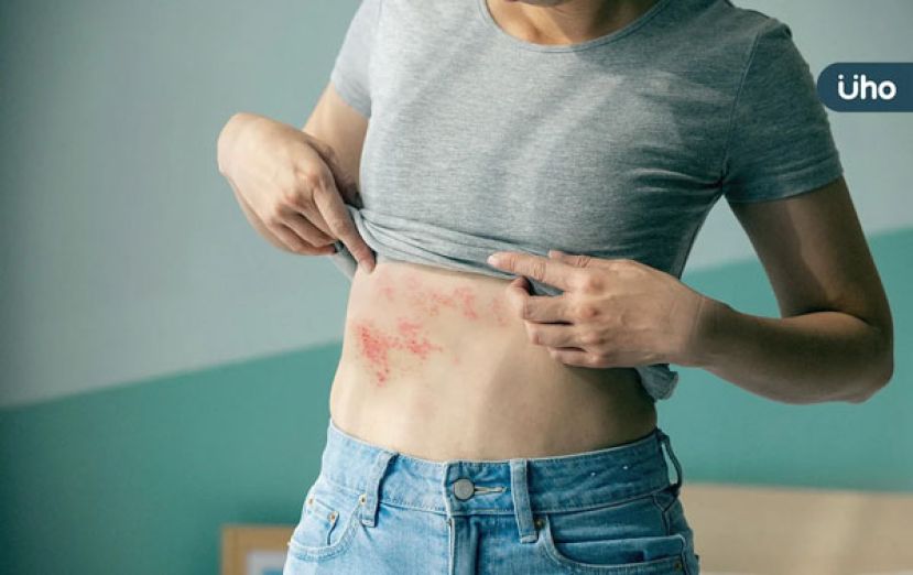 发病3天出现水泡　当心带状疱疹後神经痛