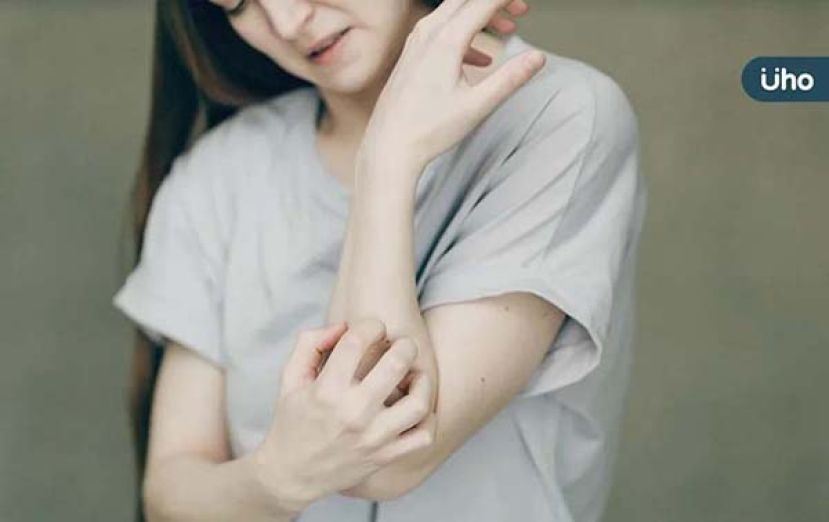 慢性搔痒每5人就有1人 年纪大更易罹患