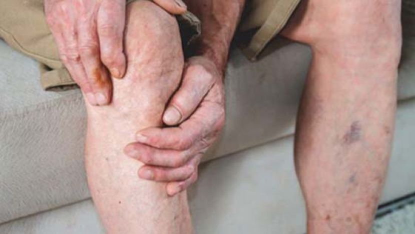 八旬老翁腿部伤口10年好不了　治疗静脉曲张终愈合