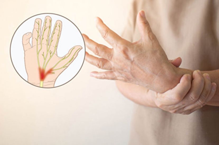 这种手麻小心腕隧道症候群！医师教你缓解