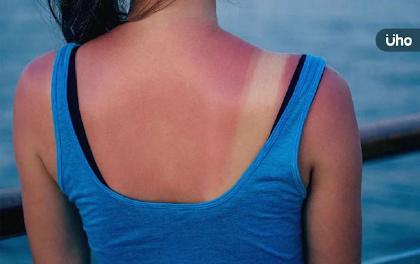 错误护理加重发炎过敏　医授正确皮肤保养4招