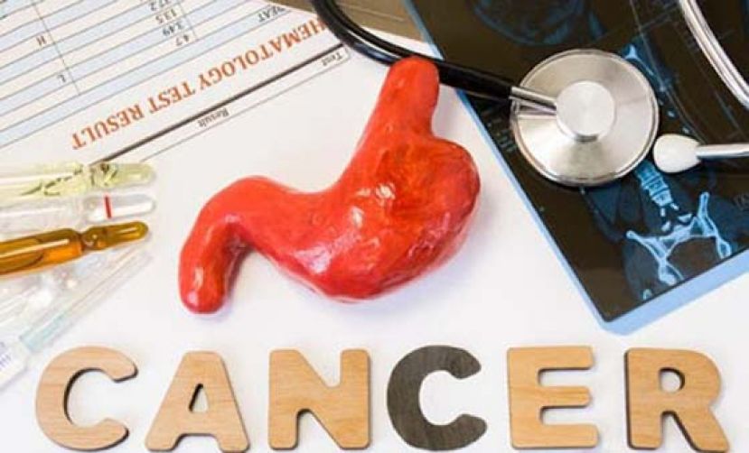 黑便、恶心想吐&hellip;竟已胃癌！ 医：这种人应每年照胃镜