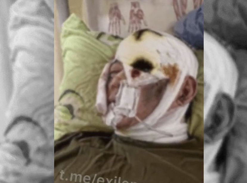 疑似唯一幸存朝鲜伤兵的近况曝光。