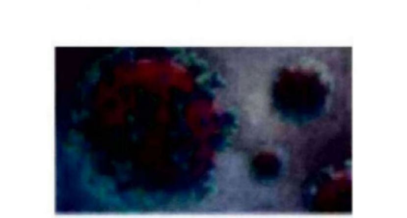 《新冠肺炎》大马新增1241确诊3病逝